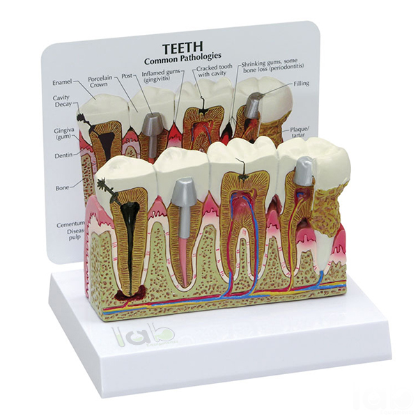 Teeth Model With Description Plate